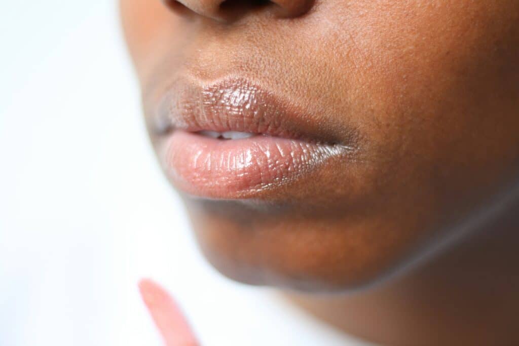 Dermal Fillers in Southampton